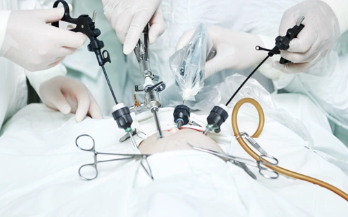 Jinekolojik Laparoskopik Cerrahi