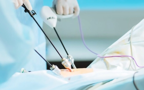 Kapalı Miyom Ameliyatı