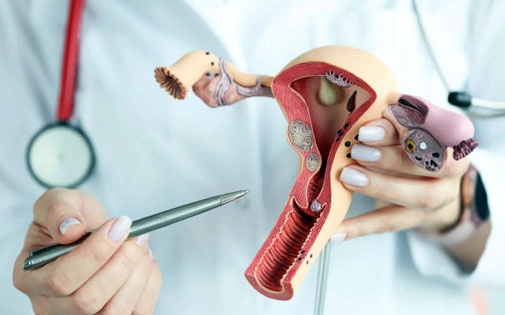 Yumurtalık (Over) Kanseri